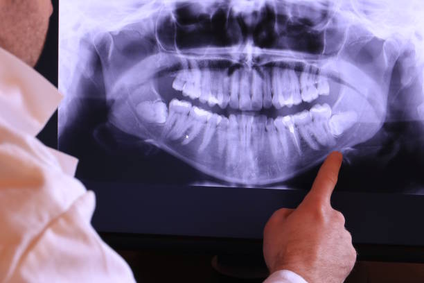 Best Urgent Dental Care for Toothache in Polkton, NC