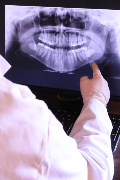 Best Emergency Dental Extractions in Polkton, NC