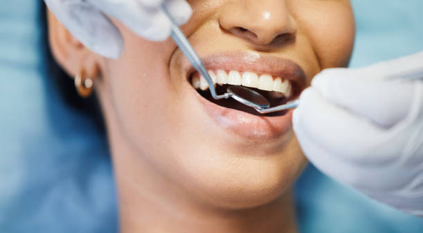 Best Broken or Cracked Tooth Emergency Dentist in Polkton, NC