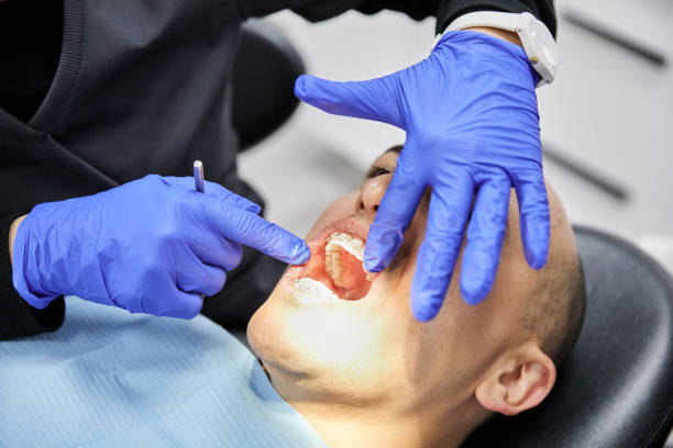 Best Emergency Dental Extractions in Polkton, NC