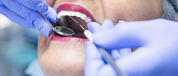 Best Emergency Dentist for Knocked-Out Tooth in Polkton, NC